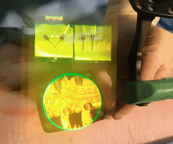 A view through an augmented reality headset used in spine surgery